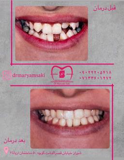 تصویر گالری مریم صاکی 1