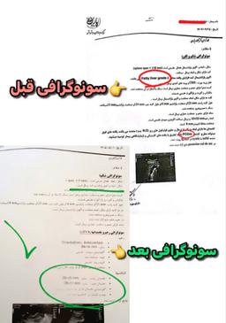 تصویر گالری فاطمه زهرا امینی پزوه 4