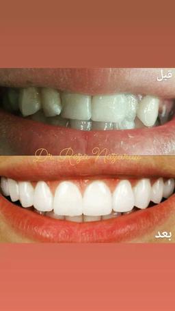 تصویر گالری رضا نظرعلی 8