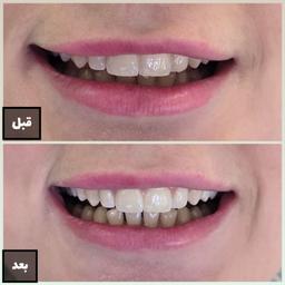 تصویر گالری سمانه فلاح 8
