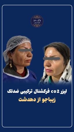 تصویر گالری بهنام روائی 21