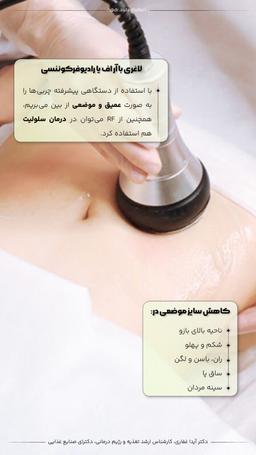 تصویر گالری آیدا غفاری آشتیانی 5