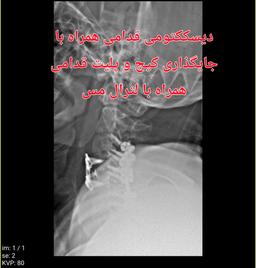تصویر گالری محمد قلعه ئی 7