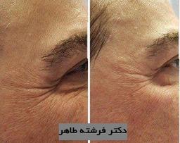 تصویر گالری فرشته طاهر 3