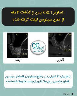 تصویر گالری مهتا ویسی 8