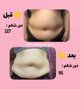 تصویر گالری نسترن رفیعی پور 11