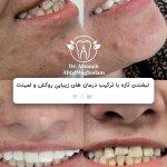 تصویر گالری افسانه آبیزی مقدم 7