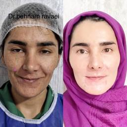 تصویر گالری بهنام روائی 20