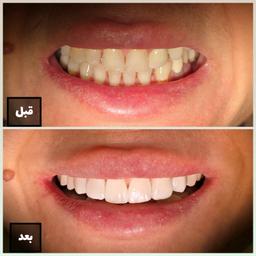 تصویر گالری سمانه فلاح 5
