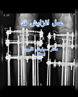تصویر گالری سیاوش قاروی آهنگر 1