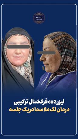 تصویر گالری بهنام روائی 22