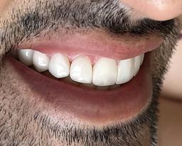 تصویر گالری فائزه فعله گری 8