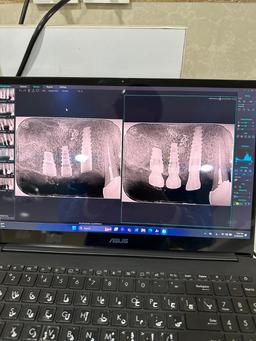 تصویر گالری علی اصغر احمدی کوچی 7