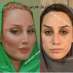 تصویر گالری بهنام روائی 25