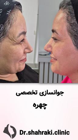 تصویر گالری سعید شهرکی 4