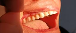 تصویر گالری چنگیز گلی پور قراتلو 2