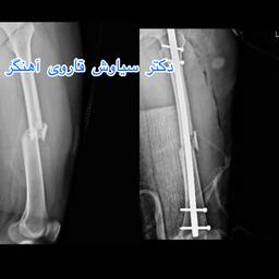 تصویر گالری سیاوش قاروی آهنگر 3