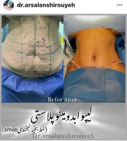 تصویر گالری ارسلان شیرویه 5