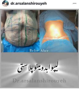 تصویر گالری ارسلان شیرویه 6
