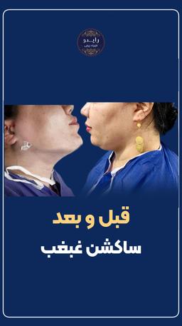 تصویر گالری بهنام روائی 23