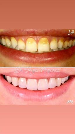 تصویر گالری رضا نظرعلی 18