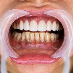 تصویر گالری زینب یوسفوند 5