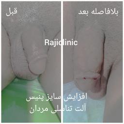 تصویر گالری بهزاد راجی فر 3
