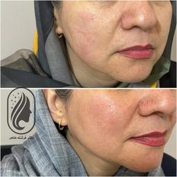 تصویر گالری فرشته طاهر 6