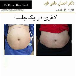 تصویر گالری احسان حامی فرد 5