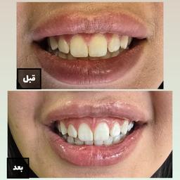 تصویر گالری سمانه فلاح 7