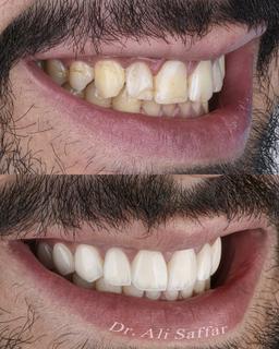تصویر گالری علی صفارحاج حسینی 8