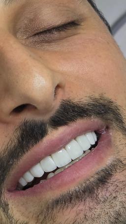 تصویر گالری فائزه فعله گری 3
