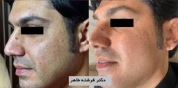 تصویر گالری فرشته طاهر 2