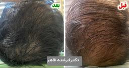 تصویر گالری فرشته طاهر 1