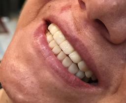 تصویر گالری فائزه فعله گری 5