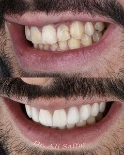 تصویر گالری علی صفارحاج حسینی 11