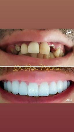 تصویر گالری رضا نظرعلی 5
