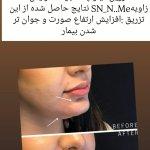 تصویر گالری ملیحه هزارخوانی 64