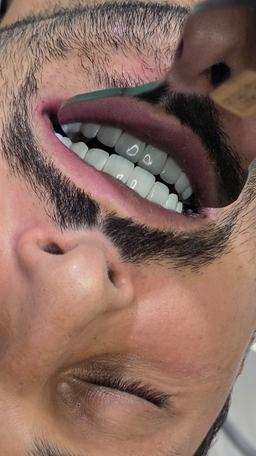 تصویر گالری فائزه فعله گری 4