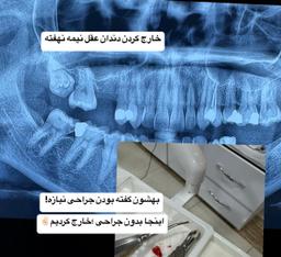 تصویر گالری علی اصغر احمدی کوچی 11
