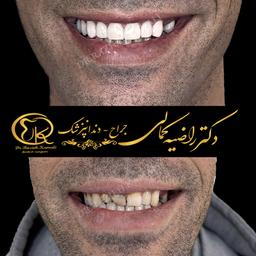تصویر گالری راضیه کمالی 4