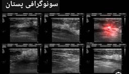 تصویر گالری نسرین امینی 27