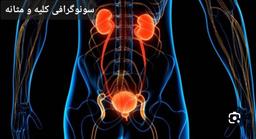 تصویر گالری نسرین امینی 14