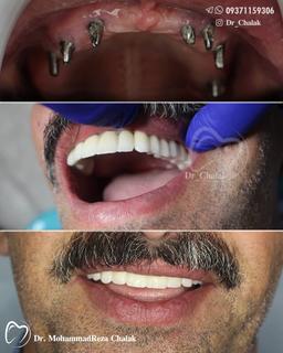 تصویر گالری محمدرضا چالاک 4