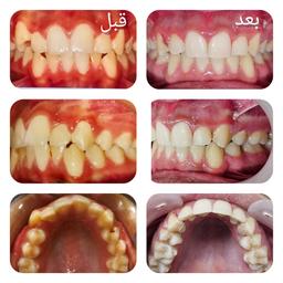 تصویر گالری طیبه مماوی 1