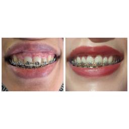 تصویر گالری شبنم خلیفه زاده 1
