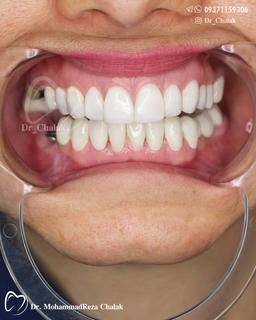 تصویر گالری محمدرضا چالاک 5