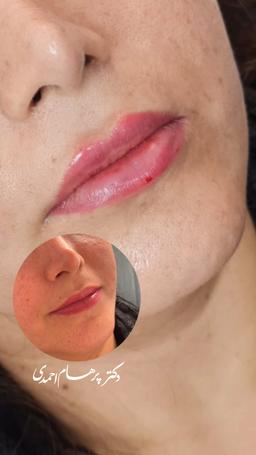 تصویر گالری سیدپرهام احمدی 2