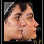 تصویر گالری فرهام احمدی 4