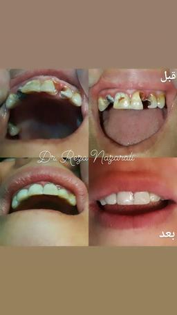 تصویر گالری رضا نظرعلی 11